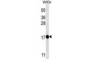 Western Blotting (WB) image for anti-Progestagen-Associated Endometrial Protein (PAEP) antibody (ABIN2998090) (PAEP antibody)