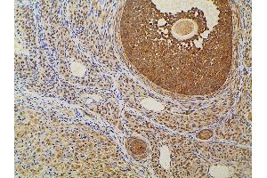 Immunohistochemistry (IHC) image for anti-Ephrin B2 (EFNB2) (C-Term) antibody (ABIN6261455)