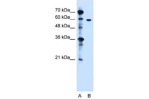 ZDHHC13 antibody used at 1. (ZDHHC13 antibody  (N-Term))