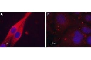 Expression of Muscarinic acetylcholine receptor M4 in C6 transfected cells - Immunocytochemical staining of paraformaldehyde-fixed and permeabilized C6 cells. (CHRM4 antibody  (AA 330-340))
