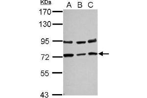WB Image Sample (30 ug of whole cell lysate) A: NT2D1 B: PC-3 C: U87-MG 7. (NGFR antibody)