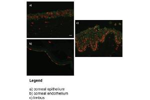 WB Suggested Anti-DPYS (dihydropyrimidinase) Antibody (Clone #:8B11)(100ug)   Titration: 0. (ZNF133 antibody  (N-Term))