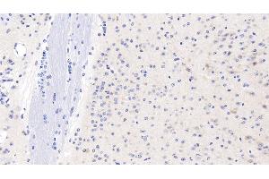 Detection of GPC1 in Mouse Cerebrum Tissue using Polyclonal Antibody to Glypican 1 (GPC1) (GPC1 antibody  (AA 155-292))