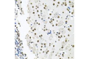 Immunohistochemistry of paraffin-embedded mouse brain using MCL1 antibody at dilution of 1:100 (x40 lens). (MCL-1 antibody)