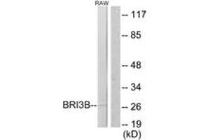 Western Blotting (WB) image for anti-BRI3 Binding Protein (BRI3BP) (AA 1-50) antibody (ABIN2879158) (BRI3BP antibody  (AA 1-50))