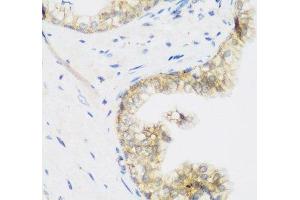 KIAA1456 antibody