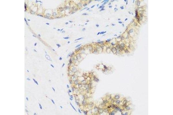 KIAA1456 antibody