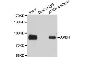 Immunoprecipitation analysis of 100ug extracts of SW480 cells using 3ug APEH antibody. (APEH antibody)