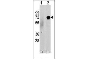 Western blot analysis of CAMKK2 (arrow) using rabbit polyclonal CAMKK2 Antibody (CAMKK2 antibody  (N-Term))