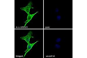 (ABIN768598) Immunofluorescence analysis of paraformaldehyde fixed A431 cells, permeabilized with 0. (GPR183 antibody  (Internal Region))