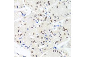 Immunohistochemistry of paraffin-embedded human stomach using HMGN1 antibody (ABIN5975005) at dilution of 1/100 (40x lens). (HMGN1 antibody)