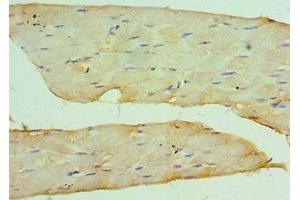 Immunohistochemistry of paraffin-embedded human skeletal muscle tissue using ABIN7149059 at dilution of 1:100 (KAT14 antibody  (AA 523-782))