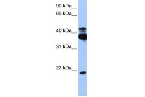 WB Suggested Anti-STK38 Antibody Titration:  0. (STK38 antibody  (C-Term))