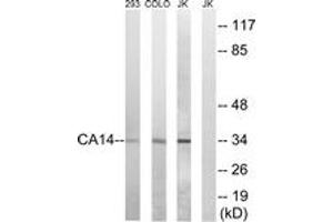 Western blot analysis of extracts from Jurkat/COLO/293 cells, using CA14 Antibody. (CA14 antibody  (AA 161-210))