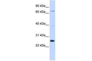 Image no. 1 for anti-Zinc Finger Protein 267 (ZNF267) (AA 288-337) antibody (ABIN6742593)