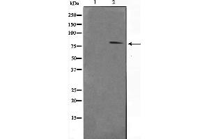 Western blot analysis of STAT1 phosphorylation expression in MCF7 whole cell lysates,The lane on the left is treated with the antigen-specific peptide. (STAT1 antibody  (pTyr701))