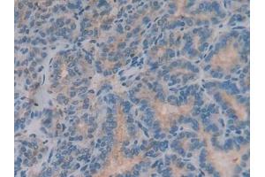 Immunohistochemistry (IHC) image for anti-beta-2-Microglobulin (B2M) (AA 22-119) antibody (ABIN7429220)