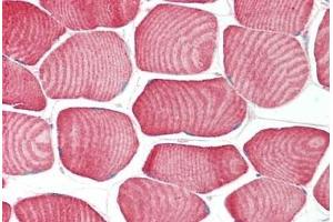 Human Skeletal Muscle: Formalin-Fixed, Paraffin-Embedded (FFPE) (FBXO32 antibody  (C-Term))