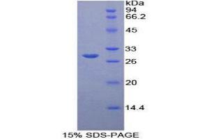 SDS-PAGE (SDS) image for B-Cell CLL/lymphoma 3 (BCL3) (AA 127-376) protein (His tag) (ABIN1878959)