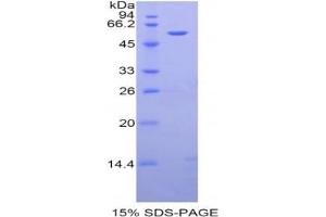 SDS-PAGE analysis of Rat Angiotensinogen Protein.