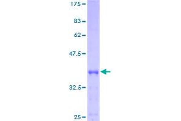 ACYP1 Protein (AA 1-99) (GST tag)