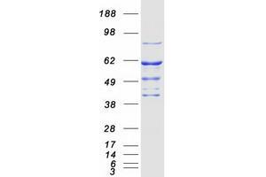 Validation with Western Blot (STK33 Protein (Myc-DYKDDDDK Tag))