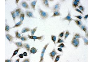 Immunohistochemistry (IHC) image for anti-Parkinson Protein 7 (PARK7) (AA 2-189) antibody (ABIN3043589)