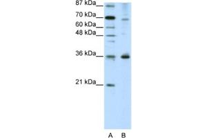 Western Blotting (WB) image for anti-Forkhead Box Q1 (FOXQ1) antibody (ABIN2461965) (FOXQ1 antibody)