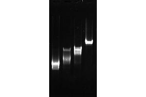 Polymerase Chain Reaction (PCR) image for Sjogren Syndrome Antigen B (SSB) (Active) protein (ABIN2452175) (SSB Protein)