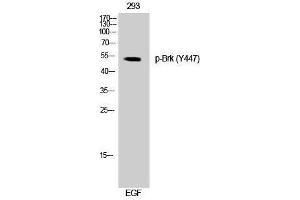 Western Blotting (WB) image for anti-PTK6 Protein tyrosine Kinase 6 (PTK6) (pTyr447) antibody (ABIN3173172) (PTK6 antibody  (pTyr447))