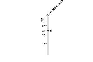 Western blot analysis of lysate from human skeletal muscle tissue lysate, using IFNGR2 Antibody (C-term) (ABIN652277 and ABIN2841159). (IFNGR2 antibody  (C-Term))