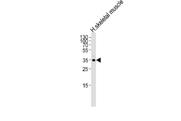 IFNGR2 antibody  (C-Term)