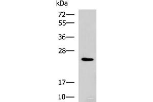 Western blot analysis of NIH/3T3 cell lysate using RAB38 Polyclonal Antibody at dilution of 1:900 (RAB38 antibody)