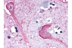 Immunohistochemical staining of Brain (Neurons and Glia) using anti- KISS1R antibody ABIN122165