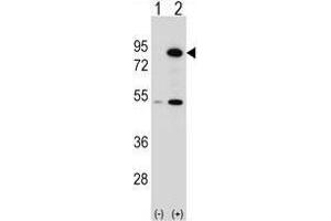 Western blot analysis of THOC1 (arrow) using rabbit polyclonal THOC1 Antibody (C-term) . (THOC1 antibody  (C-Term))