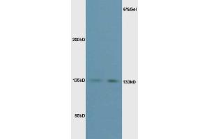 L1 mouse liver lysate L2 mouse kidney lysates probed with Rabbit Anti-Phospho-eNOS (Thr495) Polyclonal Antibody, Unconjugated  at 1:3000 for 90 min at 37˚C. (ENOS antibody  (pThr495))