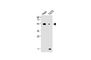 All lanes : Anti-B4GalT1 Antibody (C-term) at 1:1000 dilution Lane 1: Hela, whole cell lysate Lane 2: T47D whole cell lysate ysates/proteins at 20 μg per lane. (B4GALT1 antibody  (C-Term))