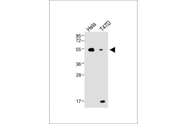 B4GALT1 Antikörper  (C-Term)