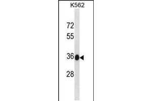 Western blot analysis in K562 cell line lysates (35ug/lane). (MMACHC antibody  (C-Term))