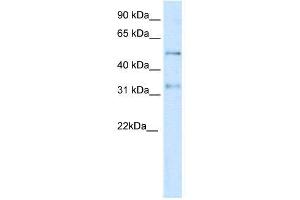 WB Suggested Anti-KCNAB2  Antibody Titration: 0.