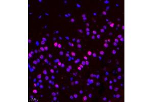 Immunofluorescence of paraffin embedded rat brain using CDY1 (ABIN7073493) at dilution of 1:400 (400x lens) (CDY1 antibody)