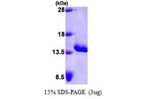 SDS-PAGE (SDS) image for Serum Amyloid A (SAA) (AA 19-122) protein (His tag) (ABIN666889) (SAA Protein (AA 19-122) (His tag))