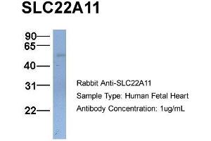 Host:  Rabbit  Target Name:  SLC22A11  Sample Type:  Human Fetal Heart  Antibody Dilution:  1.