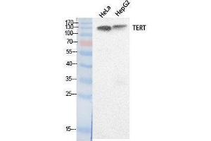 Western Blotting (WB) image for anti-Telomerase Reverse Transcriptase (TERT) (Internal Region) antibody (ABIN3178530) (TERT antibody  (Internal Region))