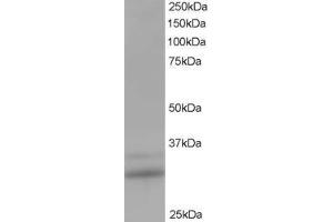 ABIN185205 staining (1 ug/ml) of Human Lung lysate (RIPA buffer, 35 ug total protein per lane). (HIV-1 Tat Interactive Protein 2, 30kDa (HTATIP2) (N-Term) antibody)
