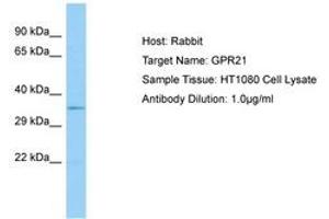 Image no. 1 for anti-G Protein-Coupled Receptor 21 (GPR21) (AA 197-246) antibody (ABIN6750101)