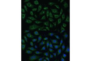 Immunofluorescence analysis of L929 cells using  Polyclonal Antibody (ABIN7265476) at dilution of 1:100 (40x lens). (ARL1 antibody  (AA 62-181))