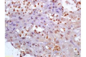 Formalin-fixed and paraffin embedded mouse placenta labeled with Anti-Glutamine PRPP amidotransferase Polyclonal Antibody, Unconjugated (ABIN872980) at 1:200 followed by conjugation to the secondary antibody and DAB staining (PPAT antibody  (AA 351-430))