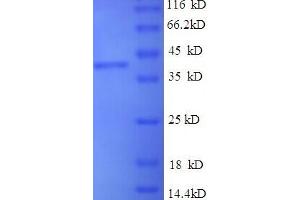 SDS-PAGE (SDS) image for Thrombospondin 1 (THBS1) (AA 19-350), (partial) protein (His tag) (ABIN5713890) (Thrombospondin 1 Protein (THBS1) (AA 19-350, partial) (His tag))