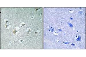 Immunohistochemistry analysis of paraffin-embedded human brain, using MLK1/2 (Phospho-Thr312/266) Antibody. (MLK1/2 antibody  (pThr312))